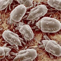 House-dust-mites